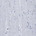 Immunohistochemical staining of human skeletal muscle shows no positivity in myocytes as expected.