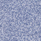 Anti-CLEC4G Antibody