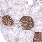 Immunohistochemical staining of human kidney shows strong membranous positivity in cells in glomeruli.