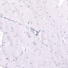 Immunohistochemical staining of human skeletal muscle shows no positivity in myocytes as expected.