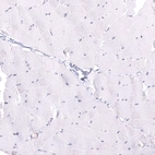 Immunohistochemical staining of human skeletal muscle shows no positivity in myocytes as expected.
