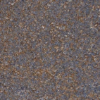 Immunohistochemical staining of human lymph node shows strong membranous positivity in non-germinal center cells.