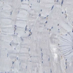 Immunohistochemical staining of human skeletal muscle shows no membranous positivity in myocytes as expected.