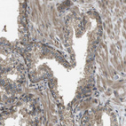 Anti-SEC62 Antibody