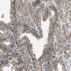 Immunohistochemical staining of human prostate shows moderate cytoplasmic positivity in glandular cells.