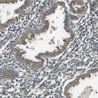 Immunohistochemical staining of human endometrium shows moderate cytoplasmic positivity in glandular cells.