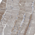 Immunohistochemical staining of human skeletal muscle shows weak cytoplasmic positivity in myocytes.