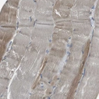 Immunohistochemical staining of human skeletal muscle shows weak cytoplasmic positivity in myocytes.