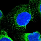 Immunofluorescent staining of human cell line A-431 shows positivity in endoplasmic reticulum.