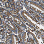 Immunohistochemical staining of human duodenum shows moderate cytoplasmic positivity in glandular cells.