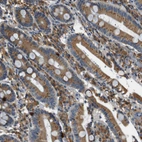 Immunohistochemical staining of human duodenum shows moderate cytoplasmic positivity in glandular cells.