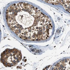 Immunohistochemical staining of human testis shows moderate cytoplasmic positivity in cells in seminiferous ducts and Leydig cells.