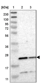 Lane 1: Marker [kDa] 230, 130, 95, 72, 56, 36, 28, 17, 11_br/_Lane 2: Human cell line RT-4_br/_Lane 3: Human cell line U-251MG sp
