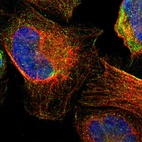Immunofluorescent staining of human cell line U-2 OS shows localization to vesicles.