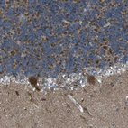 Anti-TMEM120B Antibody