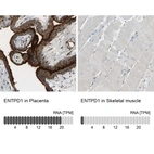 Anti-ENTPD1 Antibody