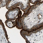 Immunohistochemical staining of human placenta shows strong cytoplasmic positivity in trophoblastic cells.