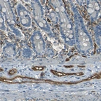 Immunohistochemical staining of human duodenum shows strong membranous positivity in endothelial cells.