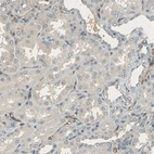 Immunohistochemical staining of human kidney shows no positivity in cells in tubules as expected.