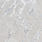 Immunohistochemical staining of human skeletal muscle shows no positivity in myocytes as expected.