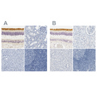 Anti-OPN1SW Antibody