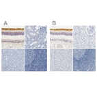 Anti-OPN1SW Antibody
