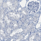 Immunohistochemical staining of human kidney shows no positivity in cells in tubules as expected.