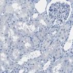 Immunohistochemical staining of human kidney shows no positivity in cells in tubules as expected.