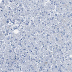 Immunohistochemical staining of human liver shows no positivity in hepatocytes as expected.