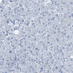 Immunohistochemical staining of human liver shows no positivity in hepatocytes as expected.