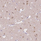 Immunohistochemical staining of human cerebral cortex shows moderate granular cytoplasmic positivity in neurons.