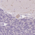 Immunohistochemical staining of human cerebellum shows moderate cytoplasmic positivity in Purkinje cells.