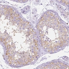 Immunohistochemical staining of human testis shows moderate membranous positivity in cells in seminiferous ducts.