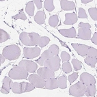 Immunohistochemical staining of human skeletal muscle shows no positivity in myocytes as expected.