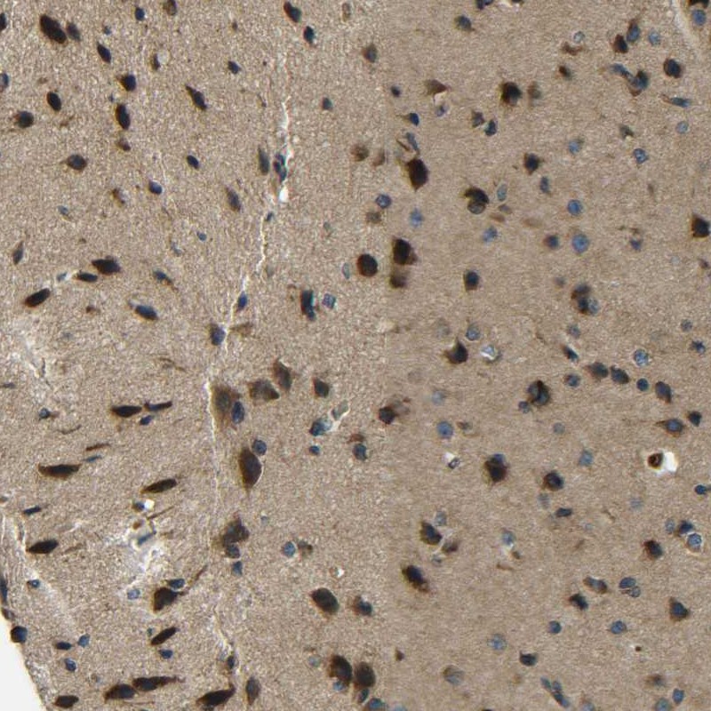 Anti-PREB Antibody
