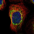 Immunofluorescent staining of human cell line A-431 shows localization to endoplasmic reticulum.