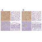 Immunohistochemical staining of human cerebral cortex, kidney, pancreas and skin using Anti-NECAB2 antibody HPA014144 (A) shows similar protein distribution across tissues to independent antibody HPA013998 (B).