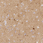 Immunohistochemical staining of human cerebral cortex shows strong cytoplasmic immunoreactivity in a subset of neurons, as well as moderate positivity in neuropil.
