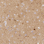 Anti-NECAB2 Antibody