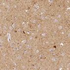 Immunohistochemical staining of human cerebral cortex shows strong cytoplasmic immunoreactivity in a subset of neurons, as well as moderate positivity in neuropil.