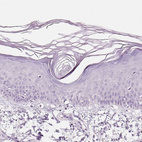 Anti-NECAB2 Antibody