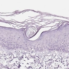 Immunohistochemical staining of human skin shows no positivity in squamous epithelial cells as expected.