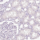 Immunohistochemical staining of human kidney showsno positivity in cells in tubules as expected.