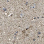 Immunohistochemical staining of human cerebral cortex using Anti-CYB5R1 antibody HPA014147.