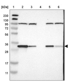 Lane 1: Marker [kDa] 230, 130, 95, 72, 56, 36, 28, 17, 11_br/_Lane 2: Human cell line RT-4_br/_Lane 3: Human cell line U-251MG sp_br/_Lane 4: Human plasma (IgG/HSA depleted)_br/_Lane 5: Human liver tissue_br/_Lane 6: Human tonsil tissue