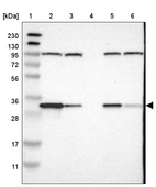 Lane 1: Marker [kDa] 230, 130, 95, 72, 56, 36, 28, 17, 11_br/_Lane 2: Human cell line RT-4_br/_Lane 3: Human cell line U-251MG sp_br/_Lane 4: Human plasma (IgG/HSA depleted)_br/_Lane 5: Human liver tissue_br/_Lane 6: Human tonsil tissue