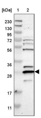 Lane 1: Marker [kDa] 230, 130, 95, 72, 56, 36, 28, 17, 11_br/_Lane 2: Human cell line RT-4