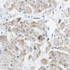 Immunohistochemical staining of human heart muscle shows weak granular cytoplasmic positivity in cardiomyocytes.