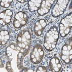 Immunohistochemical staining of human rectum shows moderate granular cytoplasmic positivity in glandular cells.