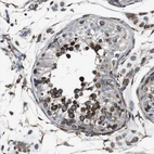Immunohistochemical staining of human testis shows strong granular cytoplasmic positivity in cells in seminiferous ducts.